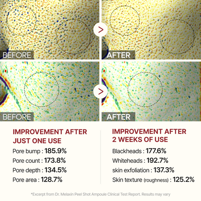 Dr. Melaxin Peel Shot Glow Rice Peeling Ampoule 80ml 2-Pack Bundle (Black Rice & White Rice) Daily Soft Exfoliating Face and Body Scrub Dead Skin Cells Blackhead Remover for All Skin Types